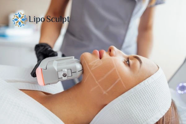 HIFU vs Botulinum Toxin: Understanding the Differences 1 HIFU vs Botox Brownhills What is the best option for you?